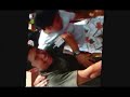 creighton bites tyler's nipple.