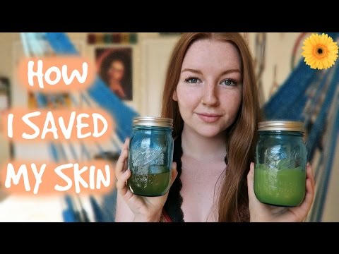 HOW I SAVED MY SKIN | DIY SKINCARE