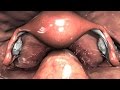 Laparoscopia-p-lvica