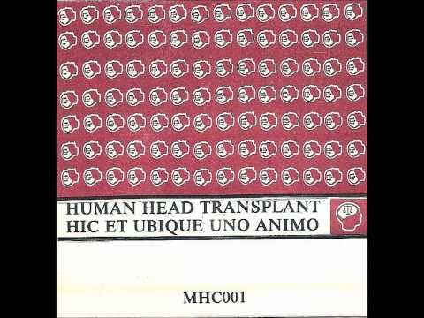 Human Head Transplant - Beyond Time