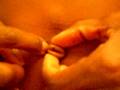 Pulling and Tying out Navel