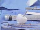 Hip Resurfacing Hip Resurfacing