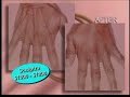 Cosmetic Makeover: Younger Hands
