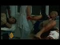 Casualties and damage in the S Ossetian conflict - 09 Aug 08