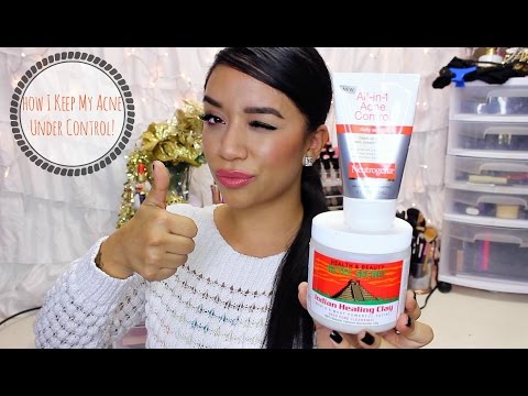 how to keep acne under control