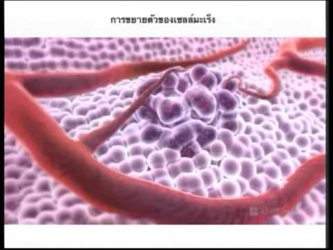 น้ำด่าง - น้ำด่างรักษามะเร็ง - ปานเทพ พัวพงษ์พันธ์.