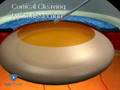 Cortical Cleaving Hydrodissection Phaco basic techniques