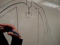CSUN - Anatomy : arm