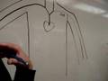 CSUN - Anatomy : arm