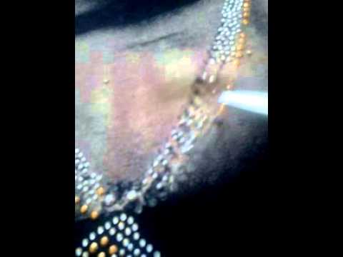 how to remove rhinestone glue from fabric