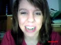 [11/14] SamanthaDH- aka BRACEFACE! =D