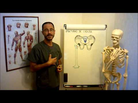 umh1729 2012-13 Lec011 Fracturas de Cadera