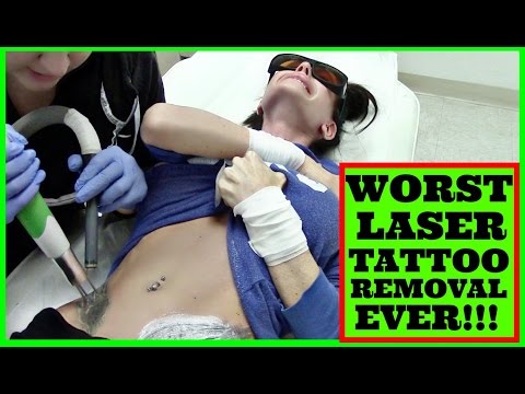 how to relieve after tattoo pain