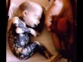 no aborto