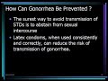 Gonorrhea-Facts