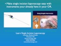Instruction Of The SILS Technique Performed