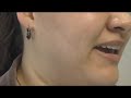 The Acne Practice (Spanish 2) The Acne Practice (Spanish 2)