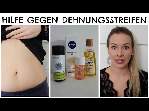 Dehnungsstreifen - Schwangerschaftsstreifen I MAMO-TALK I MamaBirdie