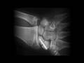 videos de Paul Goodison Promo