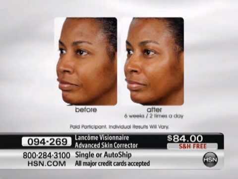 how to buy skin id