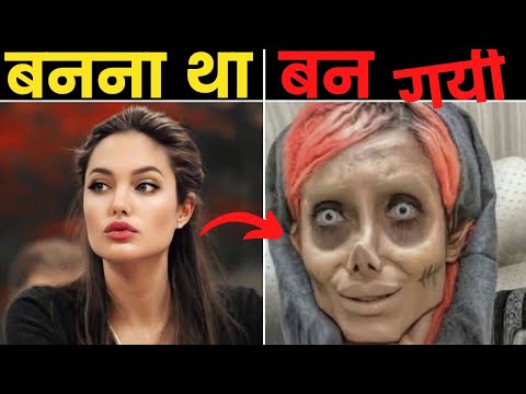 कुछ ऐसे लोग जिन्हें PLASTIC SURGERY हज़म नहीं हुयी | People Who Took Plastic Surgery To Next Level.