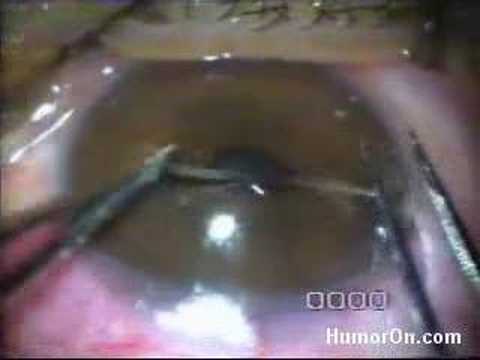how to treat gnathostomiasis