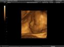 Abortion Information