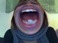 Thumbnail #1