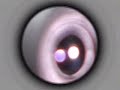 Thumbnail #3