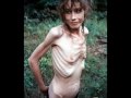 Anorexia 1 Anorexia 1