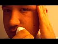 Me Draining my face... IN HD