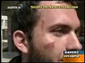 Patra-Kataggelies foithton gia astynomikh varvarothta