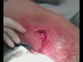 rodilla de carlos