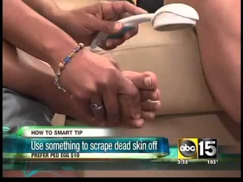 how to fix cracked heels