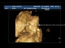 Audrey 4D Ultrasound Sept 2007