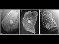 A Scientist Speaks:sarf2g A Scientist Speaks:sarf2g