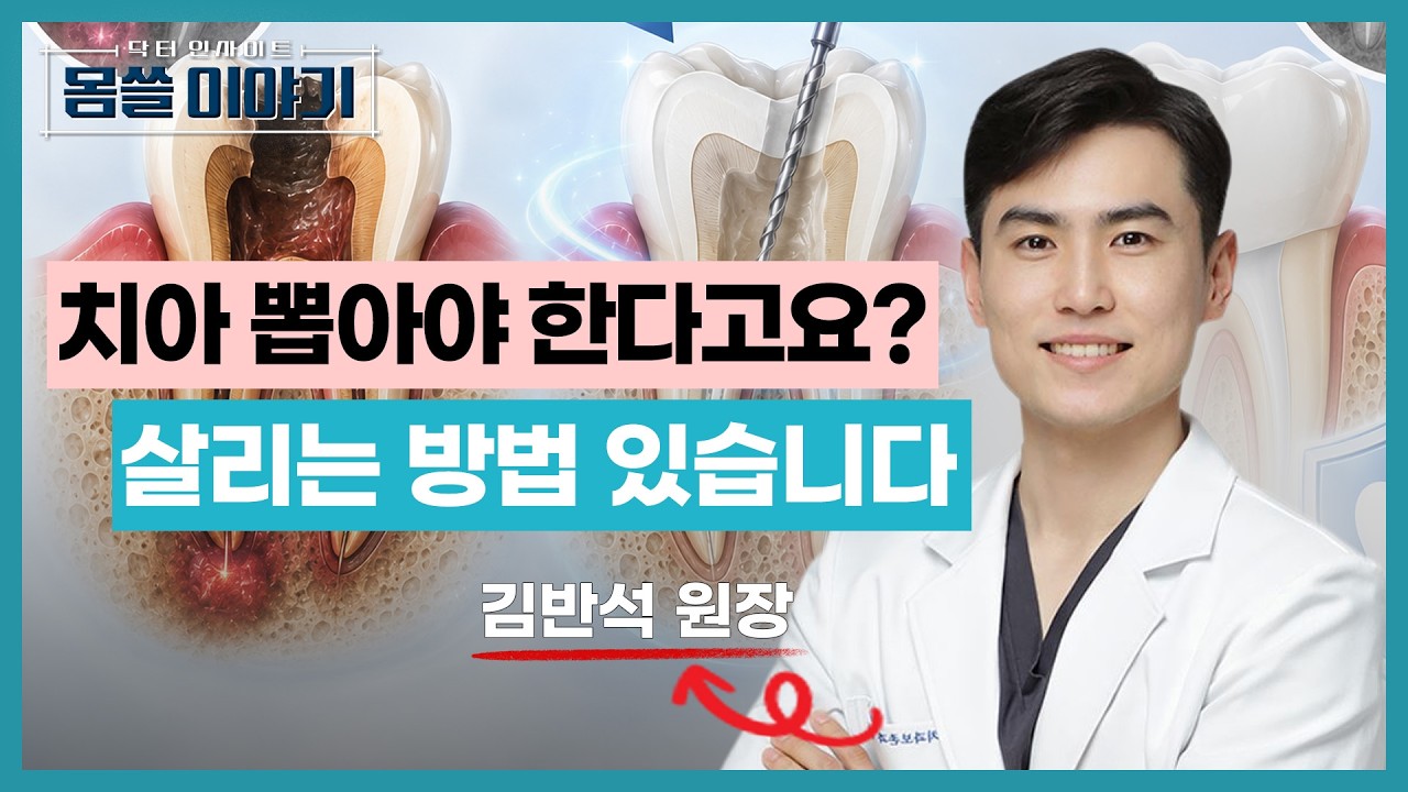 신경치료 실패해도 치아를 살리는 방법 [몸쓸이야기 23회]