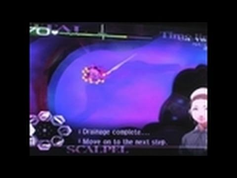 Trauma Center: Second Opinion Nintendo Wii Gameplay - Be