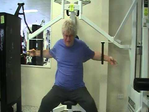 The Emergence of Ware K Tremor in a Non-patient