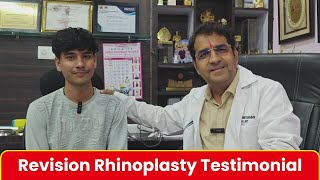 पहली सर्जरी ने तोड़ा भरोसा… लेकिन Dr. Sunil ने लौटाया आत्मविश्वास | Revision Rhinoplasty | Dr Sunil
