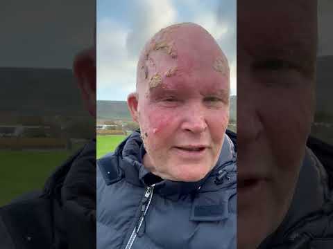 Oscar Chalupsky Health Update 26 May 26