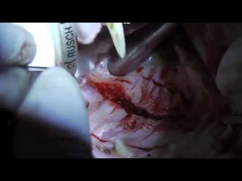 SURGERY OF THE SOFT AND HARD PALATE IN THE CAT- (cleft palate) - PALATOSCHISI GATTO