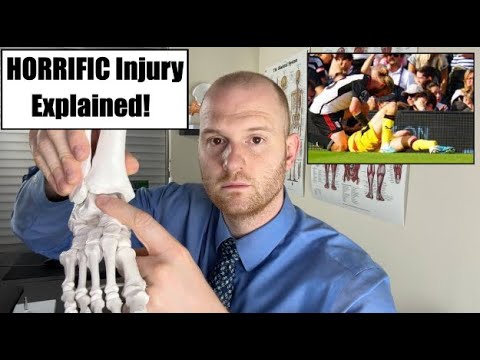 Chris Basham Injury Explained!  Chris Basham Ankle Injury