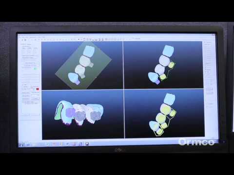 download lagu mp3 mp4 Insignia Orthodontics, download lagu Insignia Orthodontics gratis, unduh video klip Insignia Orthodontics
