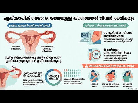 Ectopic Pregnancy — video thumbnail
