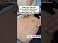 Sakit Liver Sampai Perut Sudah Membesar Solusinya Pijat Aja Dijamin Langsung Sembuh Abj Shorts
