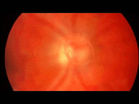 scp-7932-el parasito