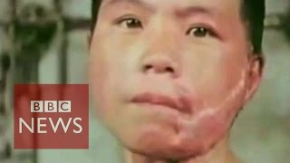 Hiroshima atomic bomb: Survivor recalls horrors - BBC News