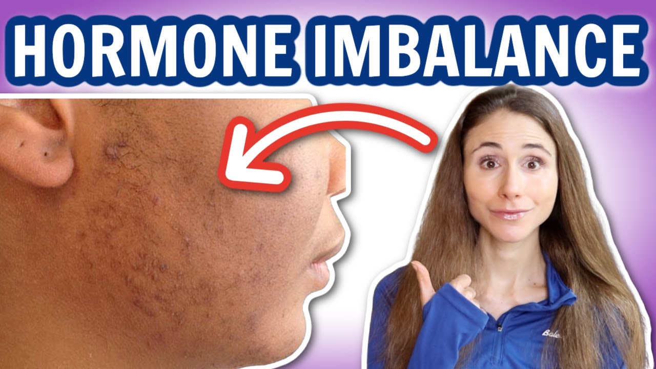 SIGNS OF HORMONE IMBALANCE IN WOMEN 💉 DERMATOLOGIST @DrDrayzday