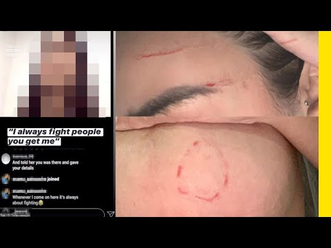 16 Year Old Threatens To Kill Love Island's Anna Vakili (She Sues!!!)